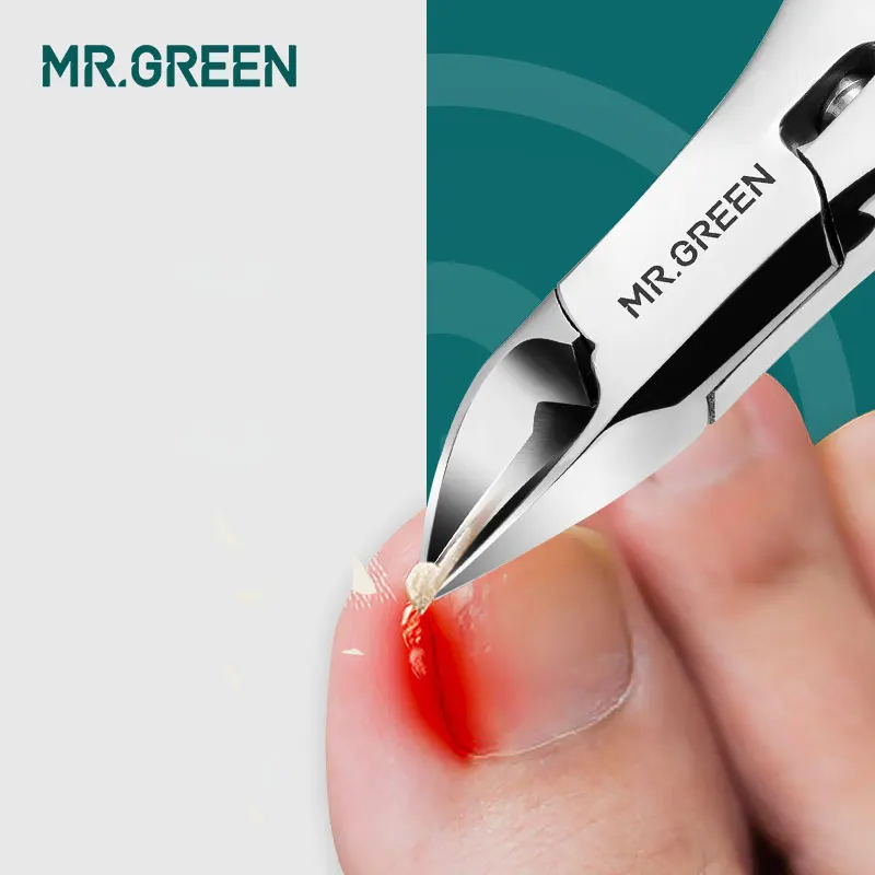 MR.GREEN инструменты для маникюра профессиональные из нержавеющей стали толстые ногти вросшие кусачки для кутикулы Триммер плоскогубцы ножницы кусачки для ногтей