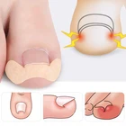 5 шт. инструмент для педикюра для вросших ногтей, средство для коррекции ногтей, лечение паронихии, фиксатор для восстановления мозолей и педикюра ног