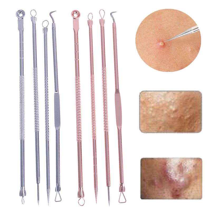 

Набор игл для удаления чёрных пятен и черных точек, 4 шт./коркор.