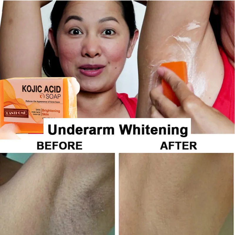 

Dark Black Skin Lightening Soap Kojic Acid Whitening Soap Kojic Acid Glycerin Brighten Face Body Skin Bleaching Turmeric Soap