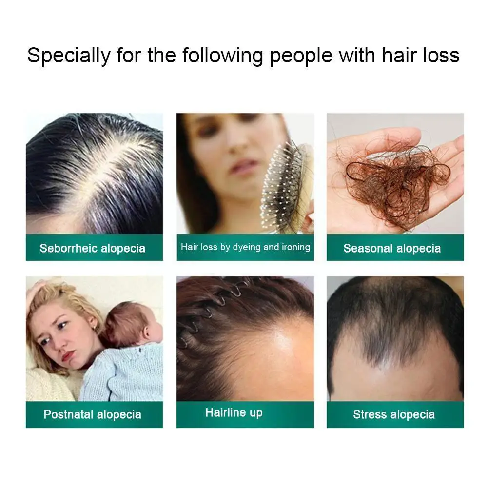 Питательный раствор для волос против выпадения 50 мл | Красота и здоровье