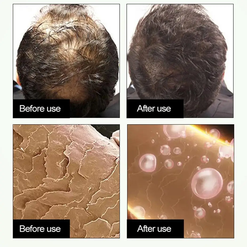 Густое эфирное масло для ухода за волосами Сыворотка лечения мужчин t