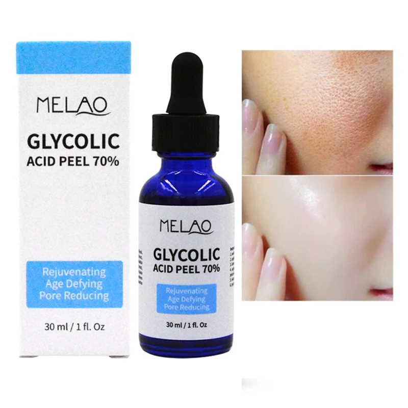 

Essence Ordinary Glycolic Acid Peel 70% Shrink Pores Brighten Skin Color Balance Water And Oil Improve Acne Skin