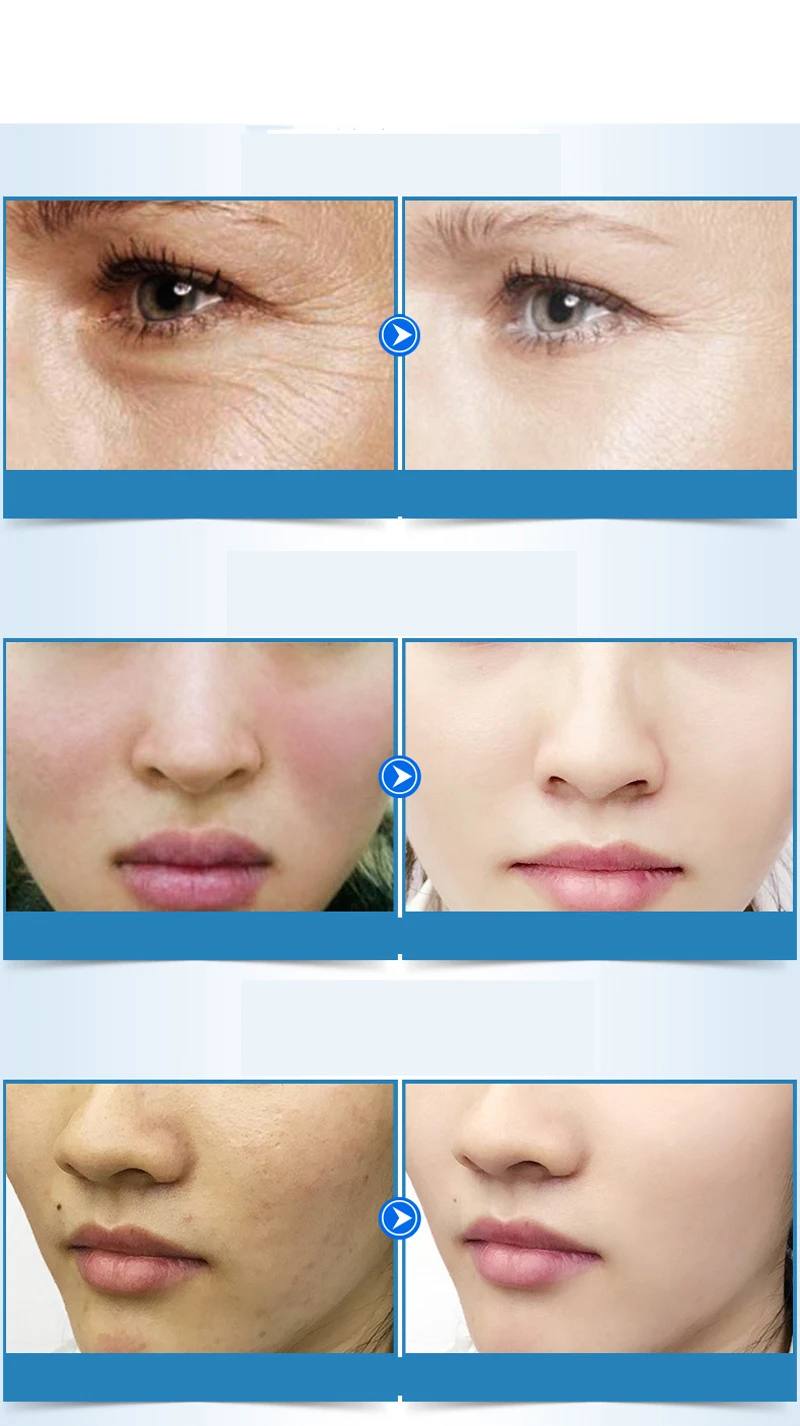 Корейская косметика сыворотка для лица эссенция коллагена натуральный шелковый