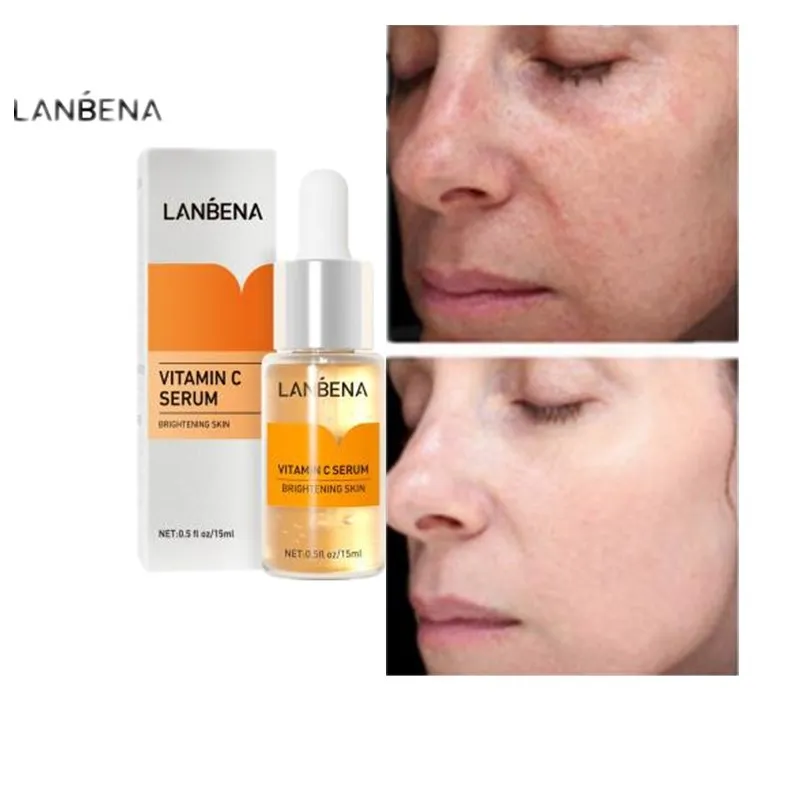 

LANBENA Vitamin C Whitening Face Serum Lighten Spots Brightening Facial Skin Essence Fade Dark Spots Remove Freckle Speckle Care