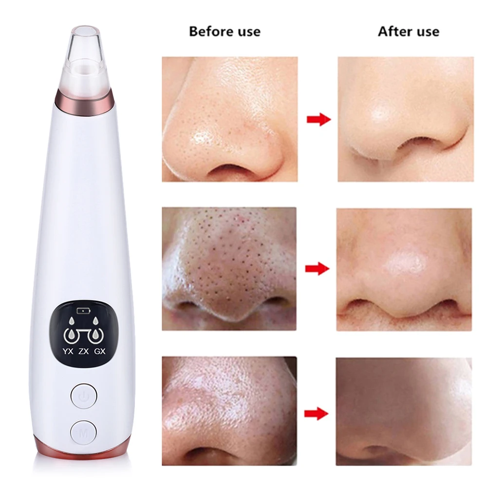 USB Перезаряжаемый прибор для удаления черных точек лица ПОР вакуум уход за кожей