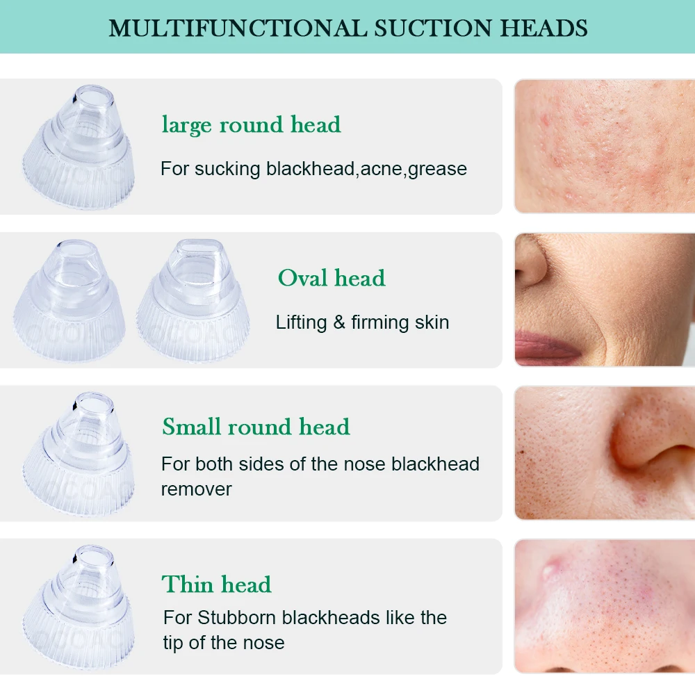 

Visual Blackhead Remover Electric Camera Vacuum Pore Cleaner Acne Removal Heating Nose Face Deep Cleansing Beauty Device