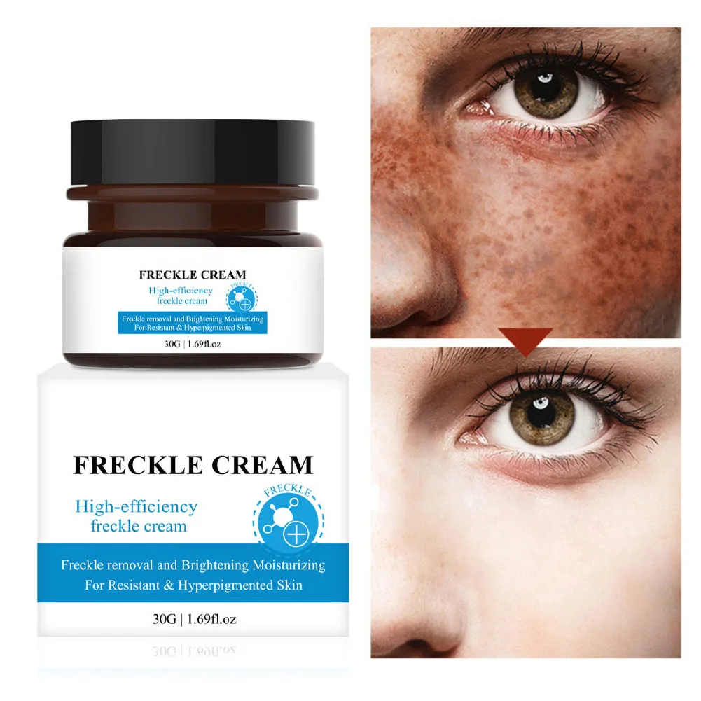 

30g Freckle Cream Hyaluronic Acid Serum Anti-wrinkle Anti-aging Moisturizing Repair Fade Freckle Melanin Skin Care