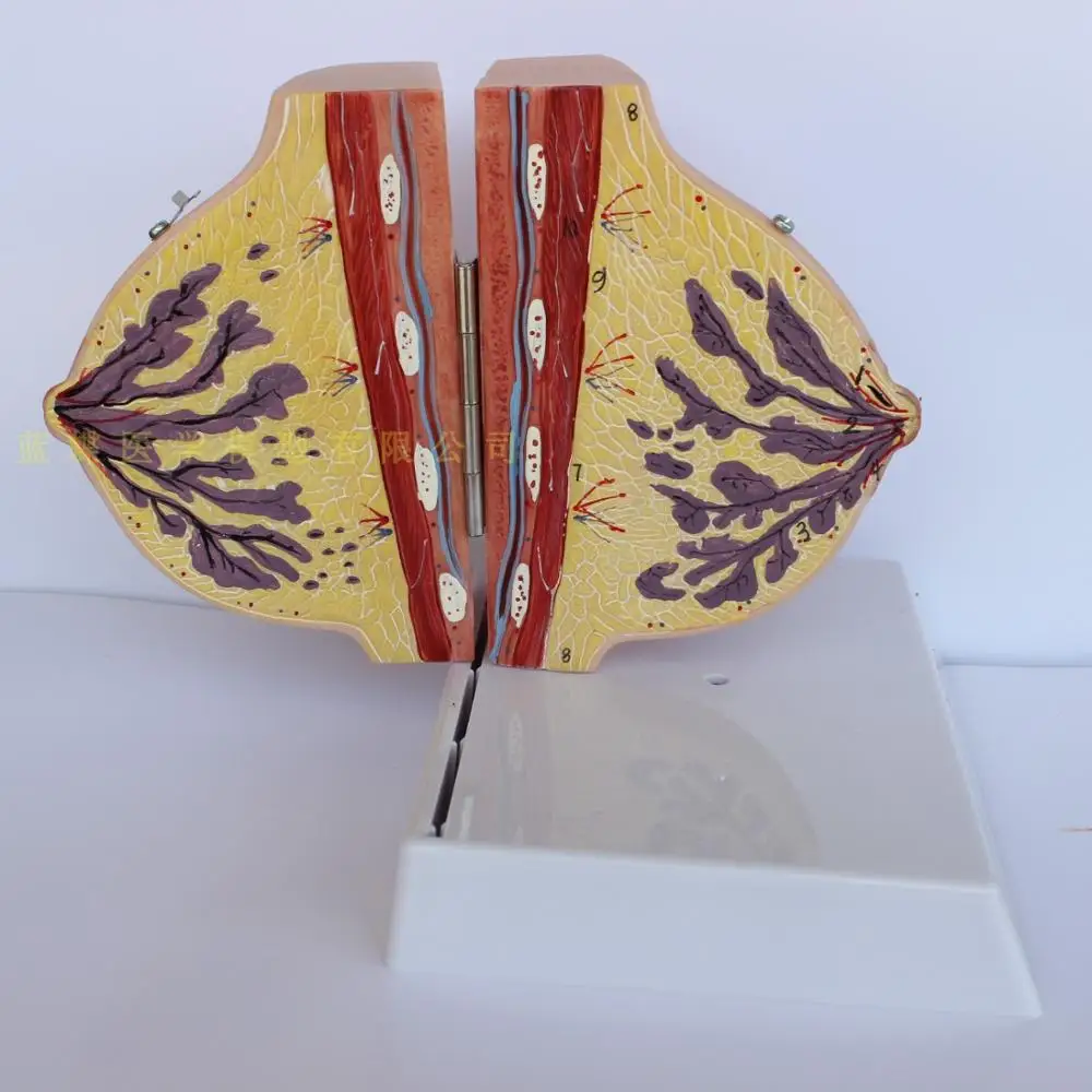 Breast disease Anatomy model Human Body Model ill/normal /lactation period free shipping | Medical Science