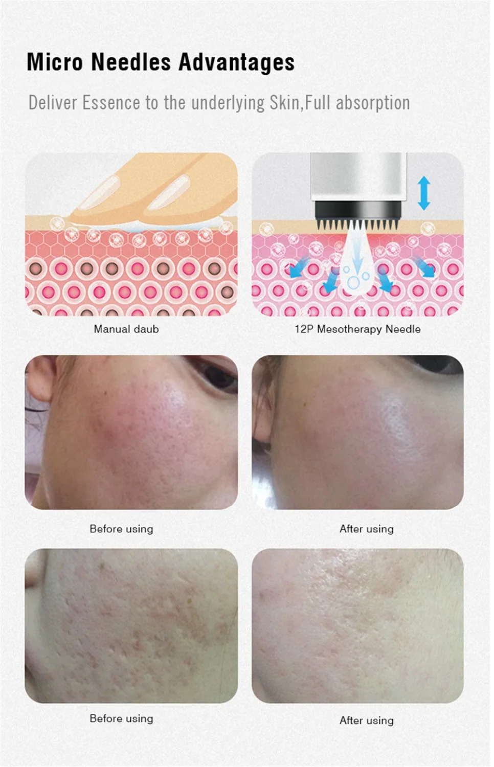 Biomaser картриджи иглы 12P МТС микроиглы полуперманентный макияж машина Профессиональный нано микроиглы татуировки высокого класса
