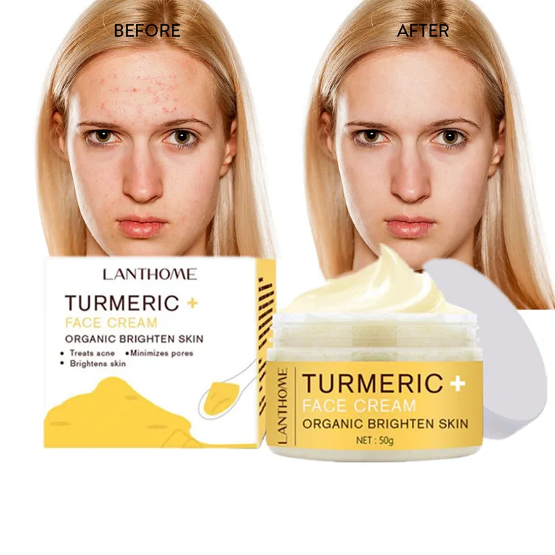 

50G Herb Turmeric Face Cream Repair Acnes Scar Dark Spot Treatment Moisturizer Whitening Lightening Against Acne Skin Care
