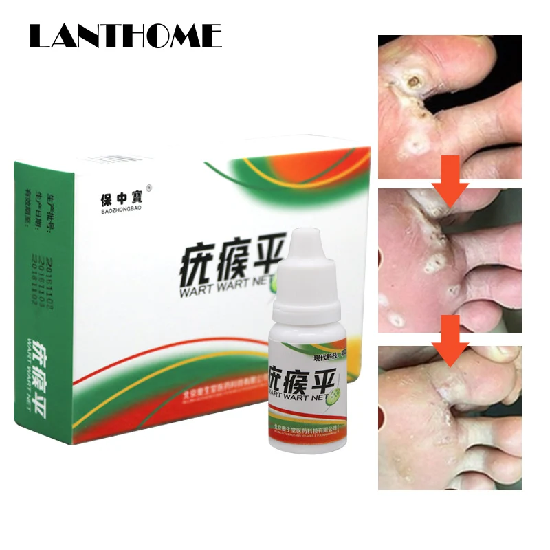 Black Dots Mole Wart Skin Tag Remover 12 Hours Tu Kill Liquid Medical Foot Corn Removal Care Solution |