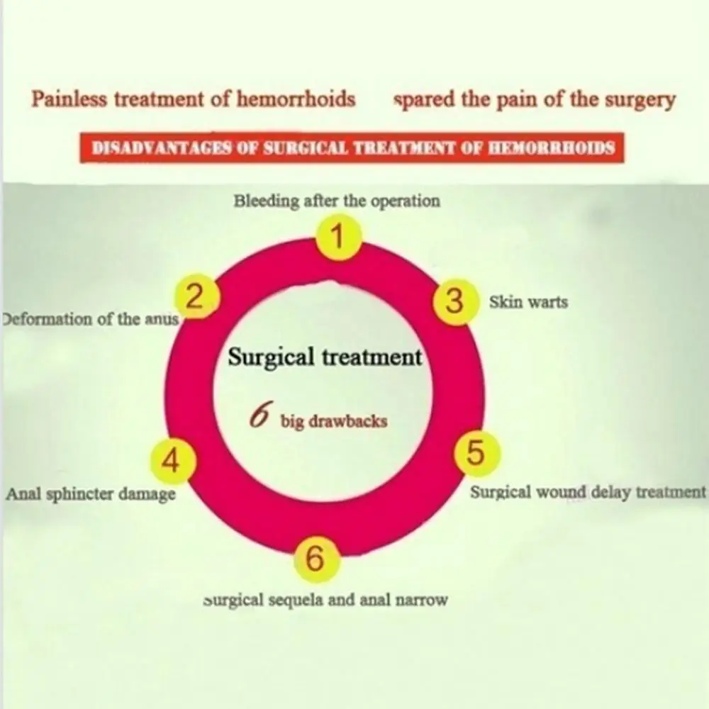 30 г китайские травяные экстракты крем от геморроя мазь внутренние наружные