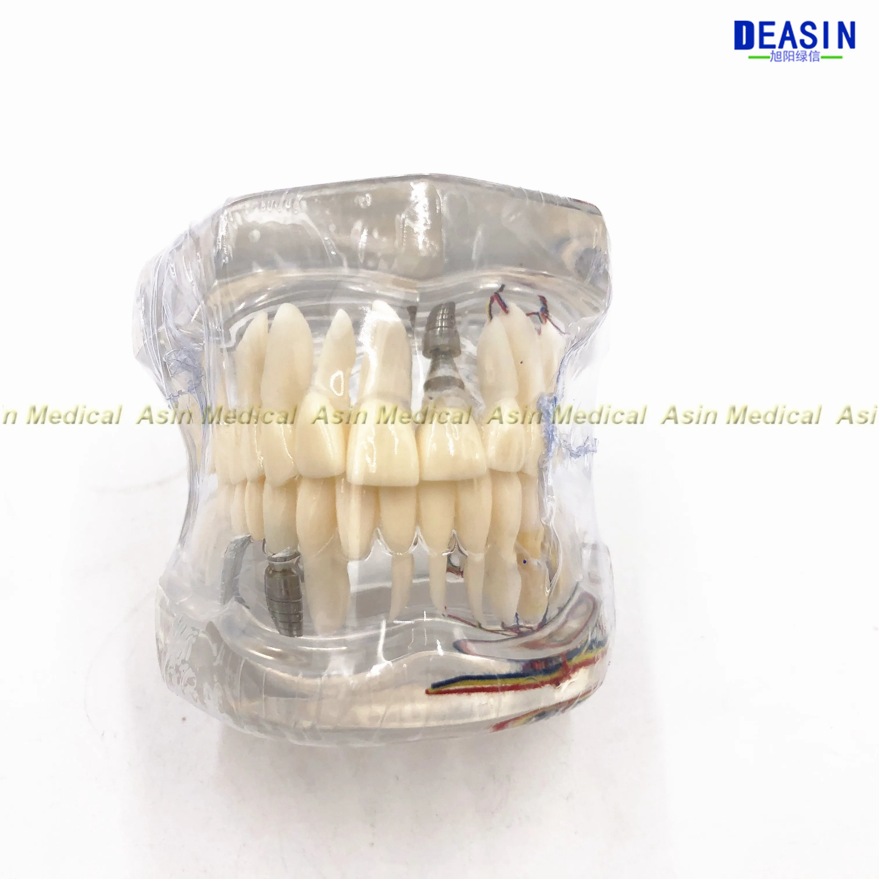 Высокое качество Стоматологическая модель зубов прозрачный патологические