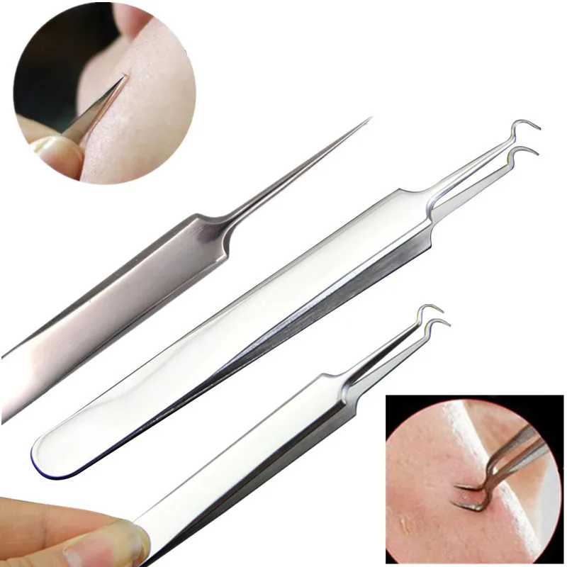 3 4 5 7 8 Pc Stainless Steel Blackhead Remover Tool Kit Whitehead Pimple Spot Comedone Acne Extractor Remover Popper Beauty Tool