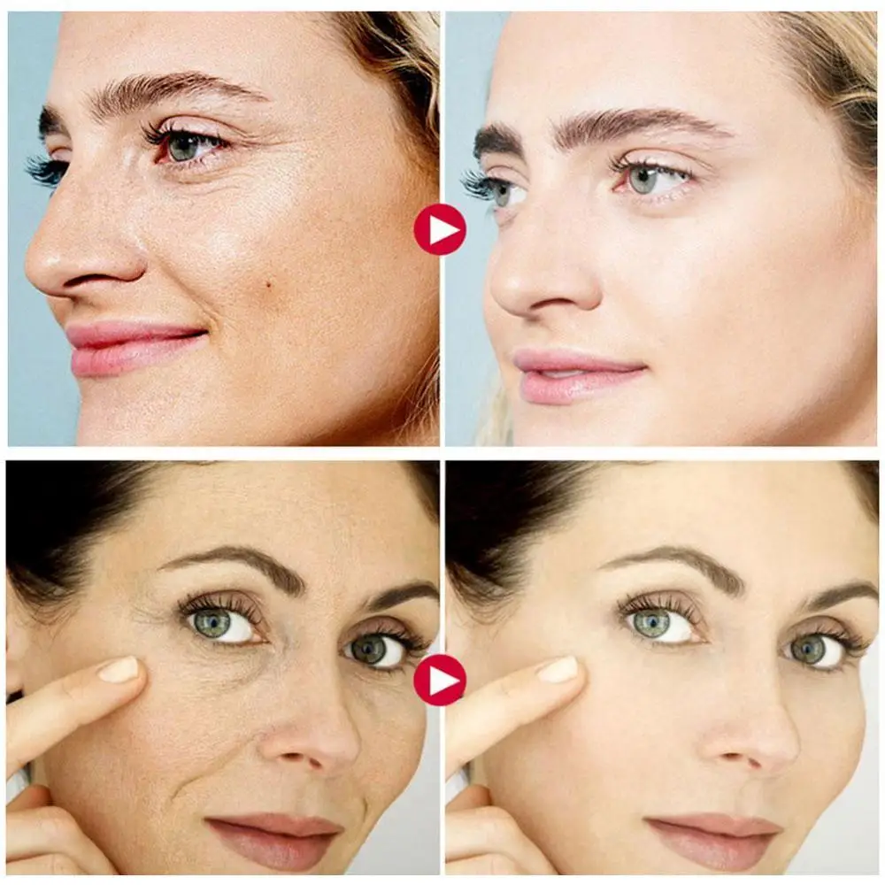 

Hyaluronic Acid Moisturizing Anti Skin Care Repair Acne Shrink Pores Oil Control Skin Care Cosmetics