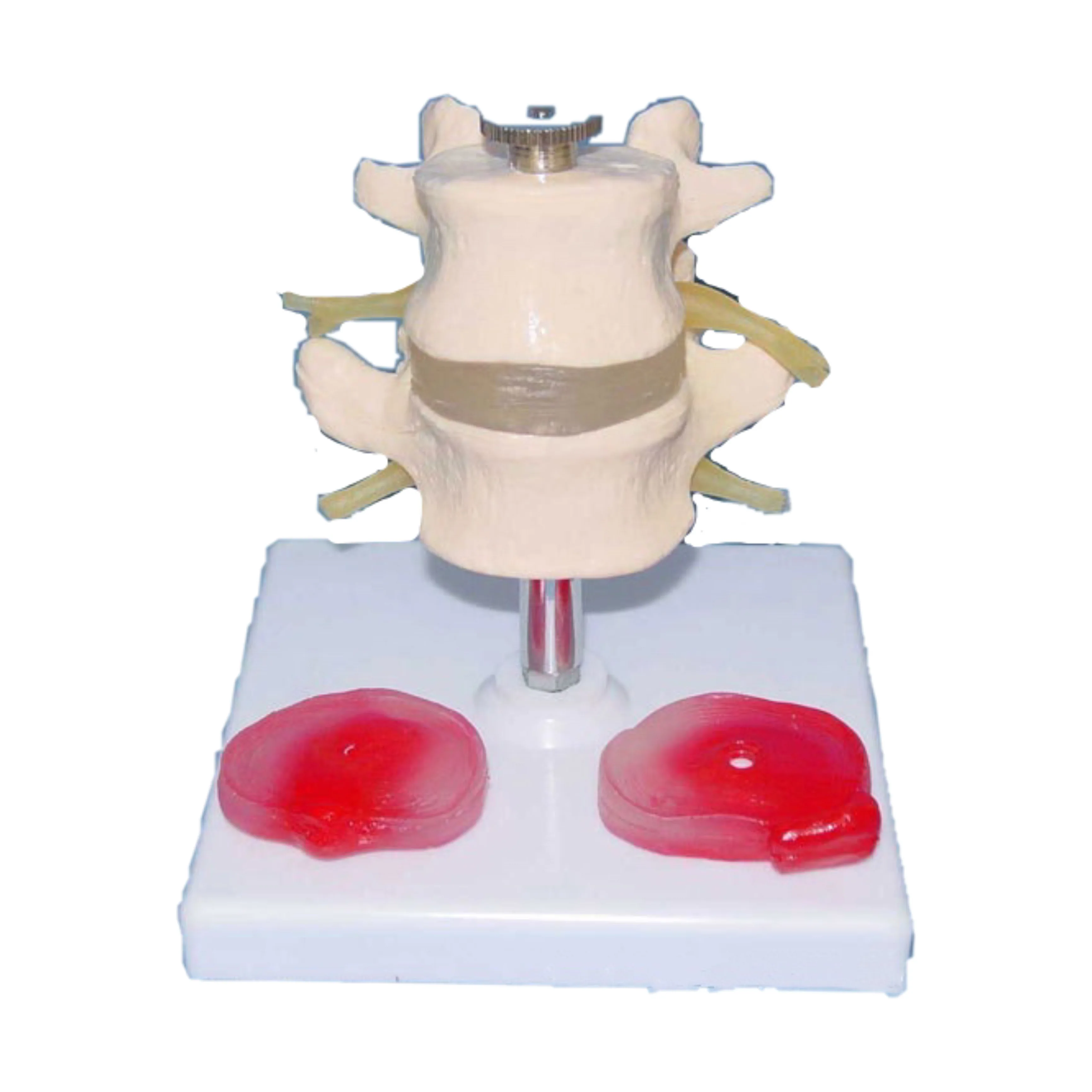 Human bones Natural large lumbar vertebrae with 3 lesions intervertebral disc comparison teaching model