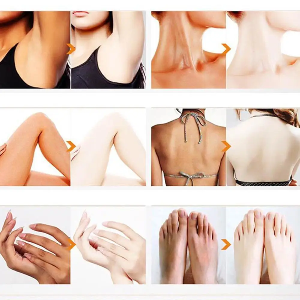

Face Body Cream skin whitening Moisturizing Body Lotion skin Bleaching Cream Underarm Dark Skin Whitening Intimate Body Lotion