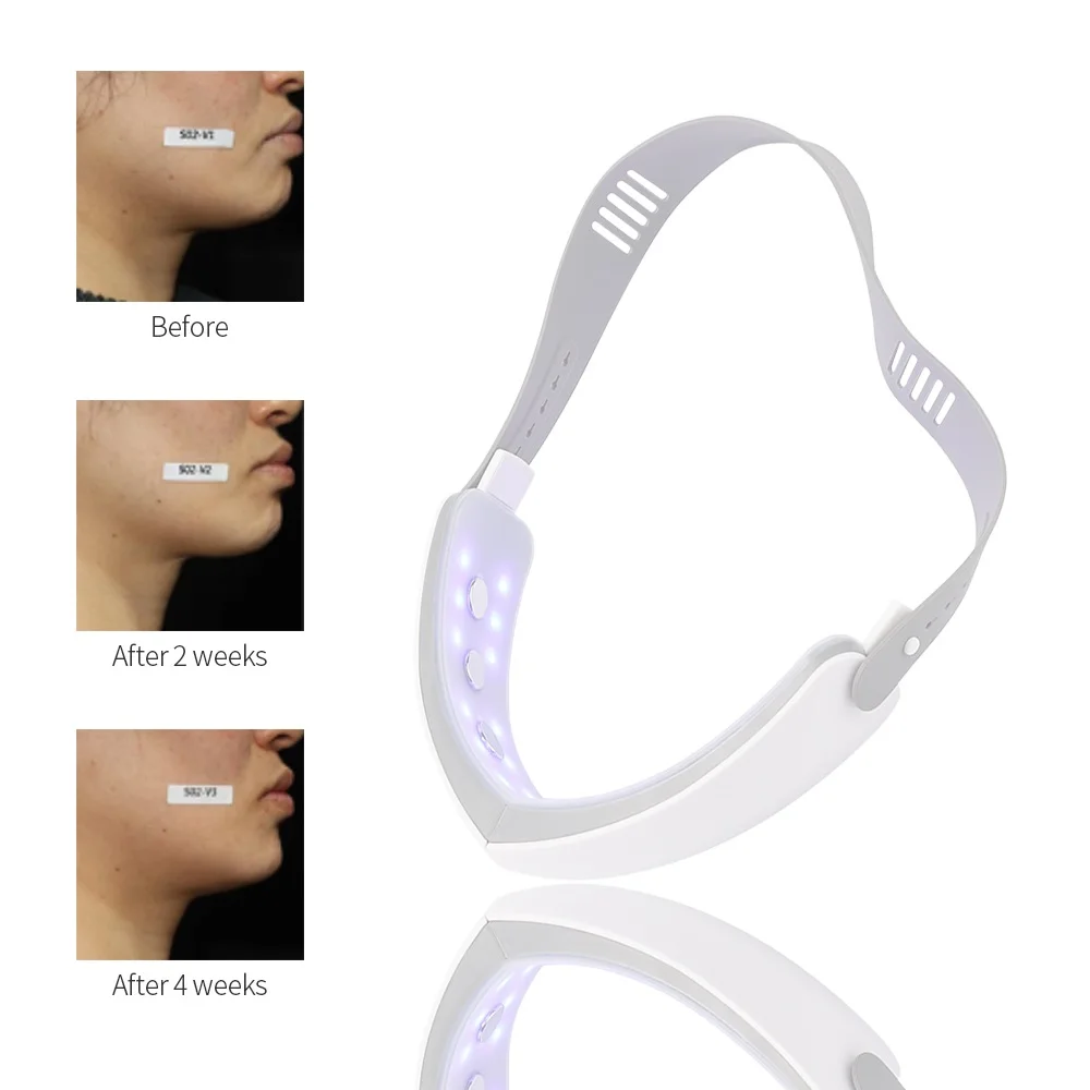 Фотонный инфракрасный Терапевтический массажер для области вокруг глаз |