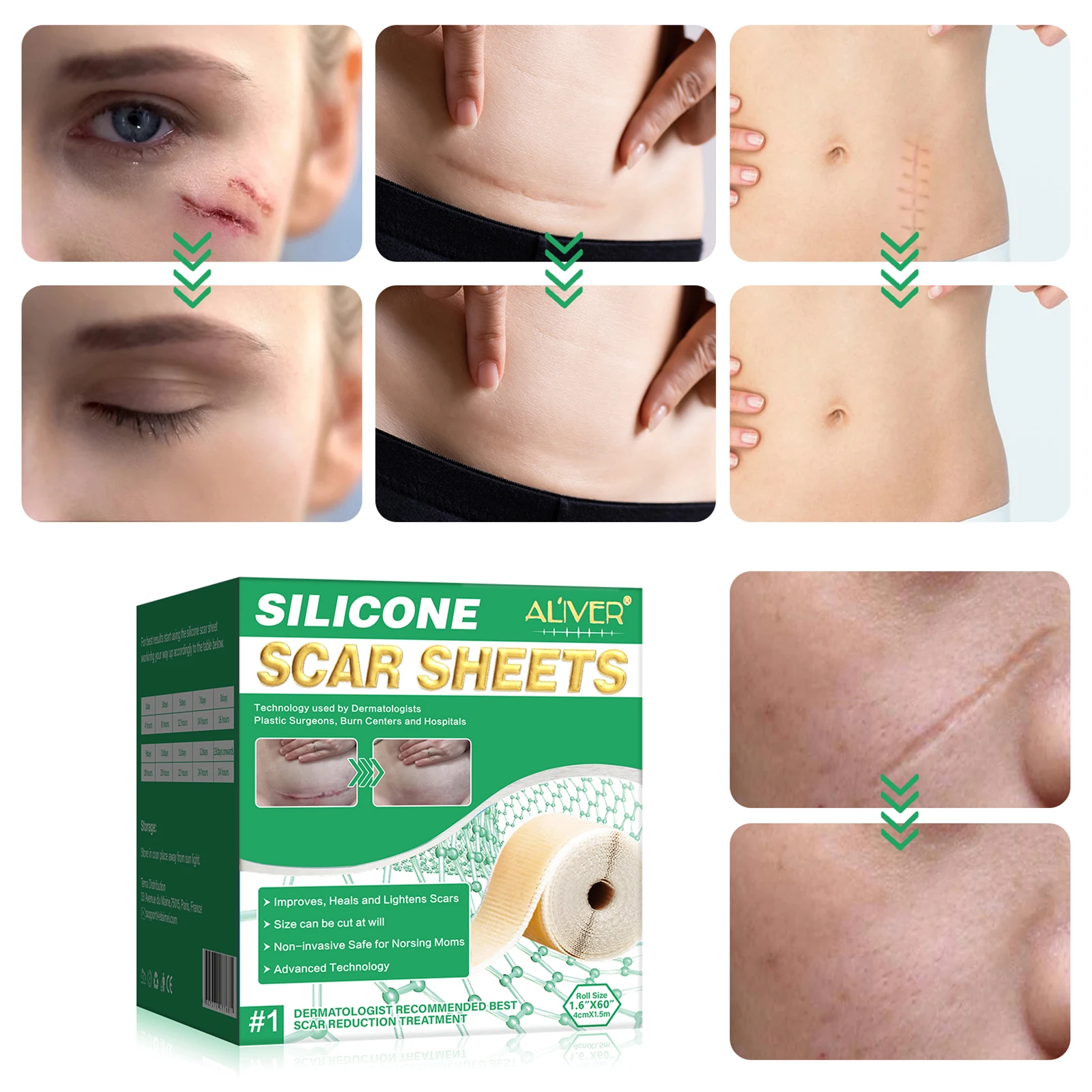 Силиконовые Гелевые полоски ALIVER пластырь силиконовые для шрамов многоразовый