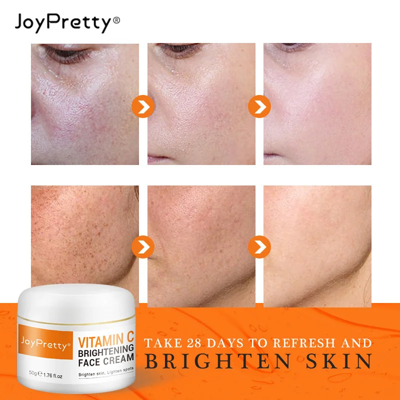 

JoyPretty Vitamin C Effective Freckle Cream Remove Spots Melanin Brightening Face Cream Even Skin Tone Nourishing Skin Care