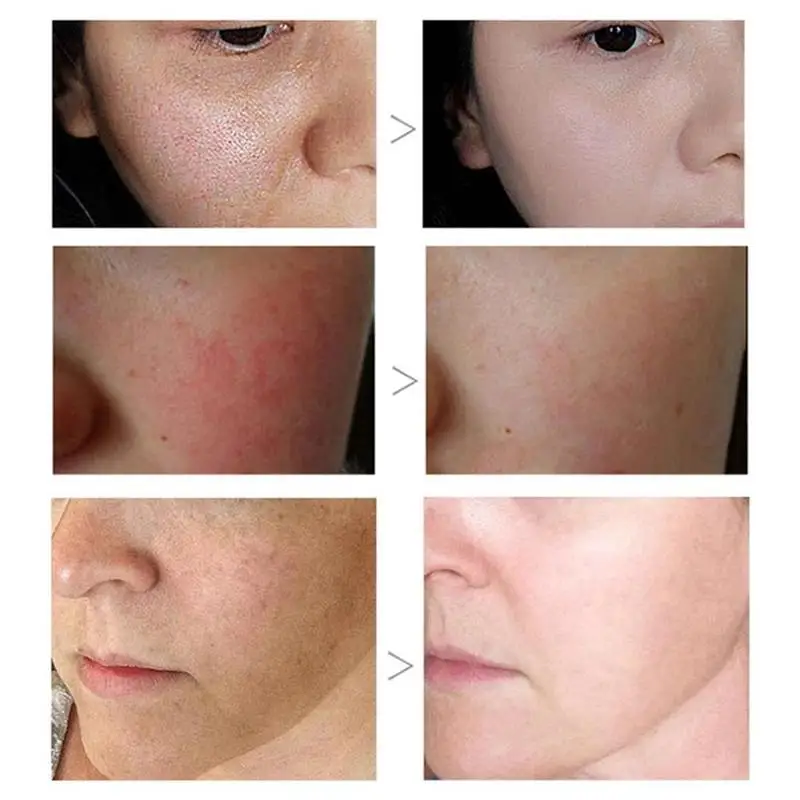 

Moisturizing Massage Cream Deep Cleaning Pores Collagen Exfoliate Cream Whitening Cream Lifting Skin