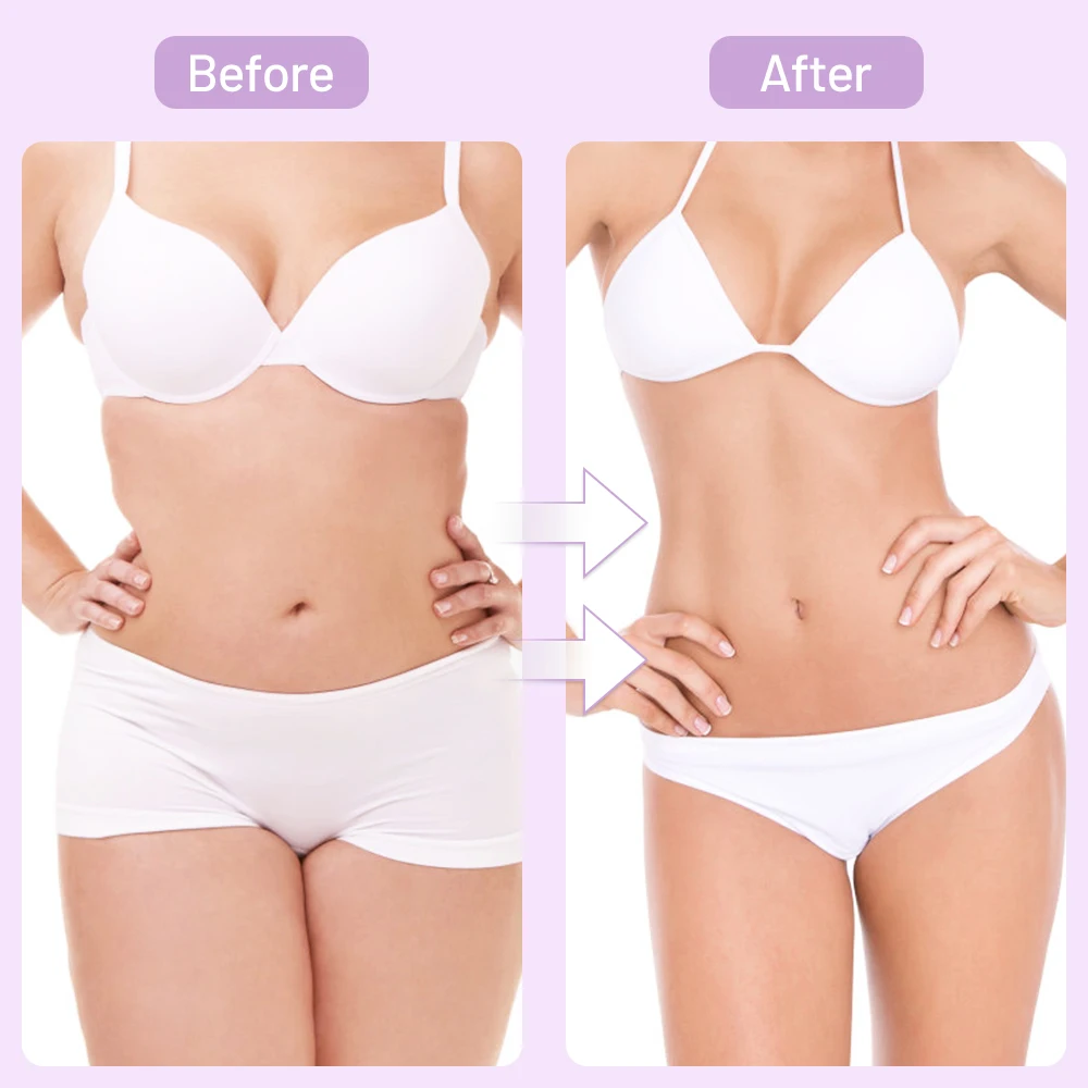 Koop 3D Ems Mini Body Slim Shaping Stimulator Ultrasone Therapie Gewichtsverlies Anti Cellulite Verminderen Acne Rimpel Face Lift Verjonging