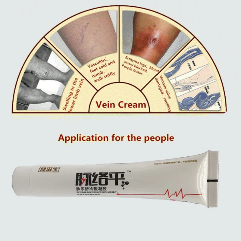 

Varicose Veins Cream For Relief Phlebitis Angiitis Leg Smearing Cream Varicose Vein Ointment Chinese Herbal Medicine
