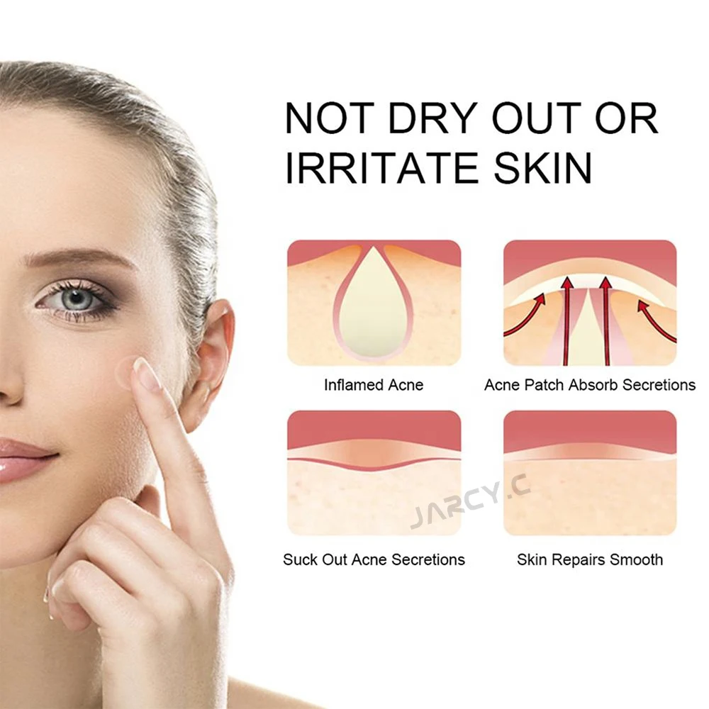 

Acne Pimple Patch Invisible Stickers Face Mask Acne Treatment Serum Face Cream Acne Essence Sheet Mask Facial Care Tools Skin