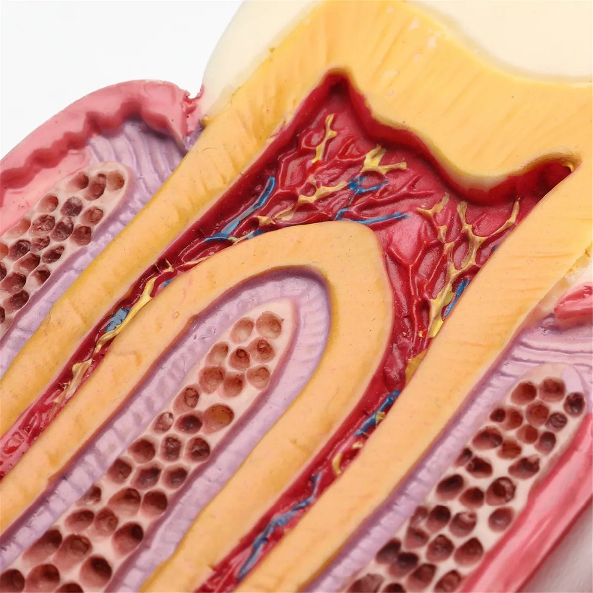 Новинка 1 шт. 6X протеза модель кариеса сравнительная Стоматолог патологий для