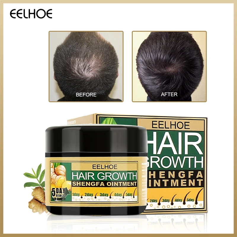 

EELHOE Hair Loss Products Natural With No Side Effects Grow Hair Faster Regrowth Hair Growth Products Ginger Hair Treatments