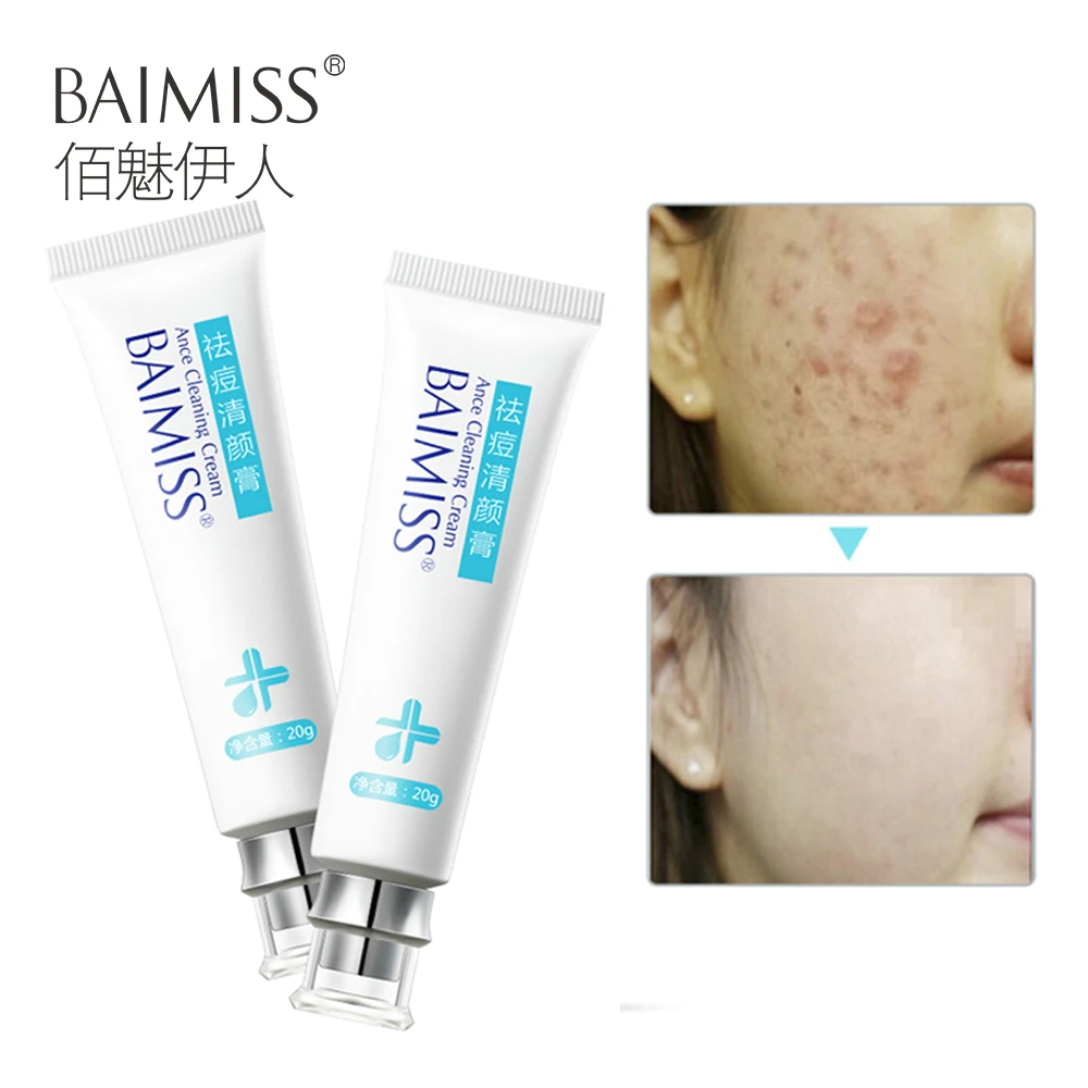 BAIMISS средство для удаления акне крем лица против пор Комедон прыщей ремонт