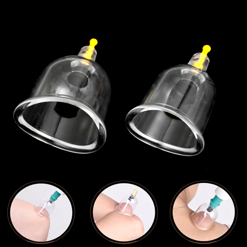 Набор медицинских банок для вакуумного массажа вакуумные банки расслабления и
