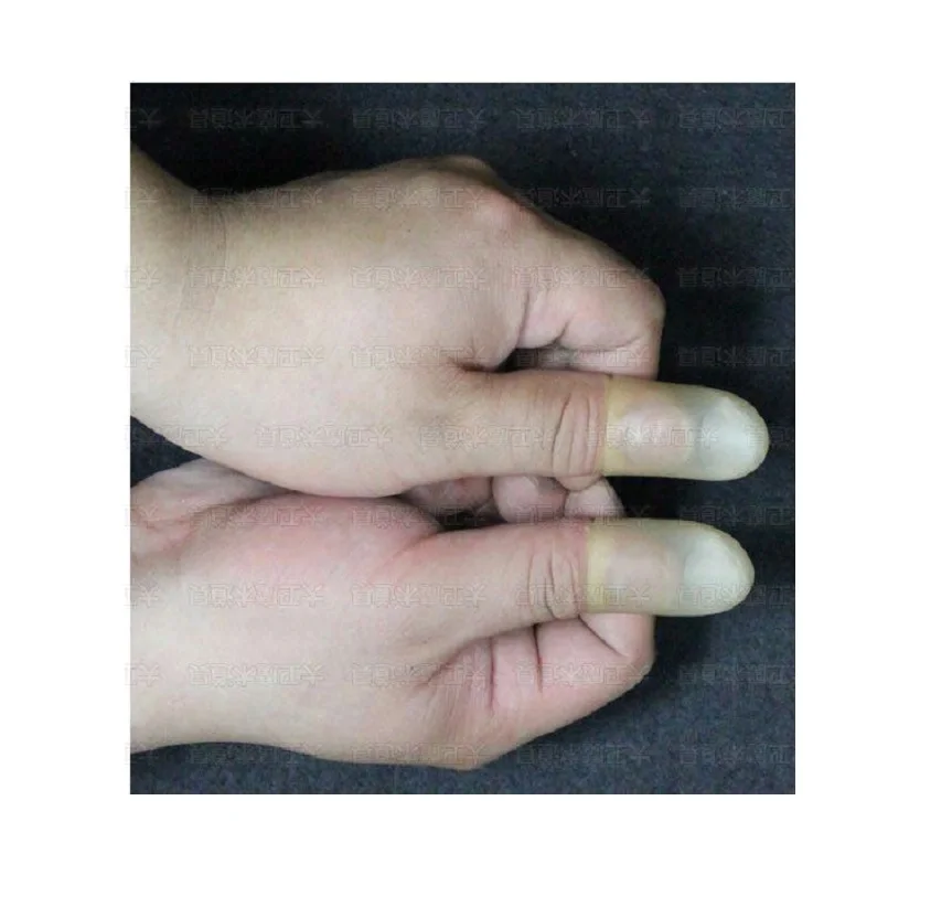 thumb