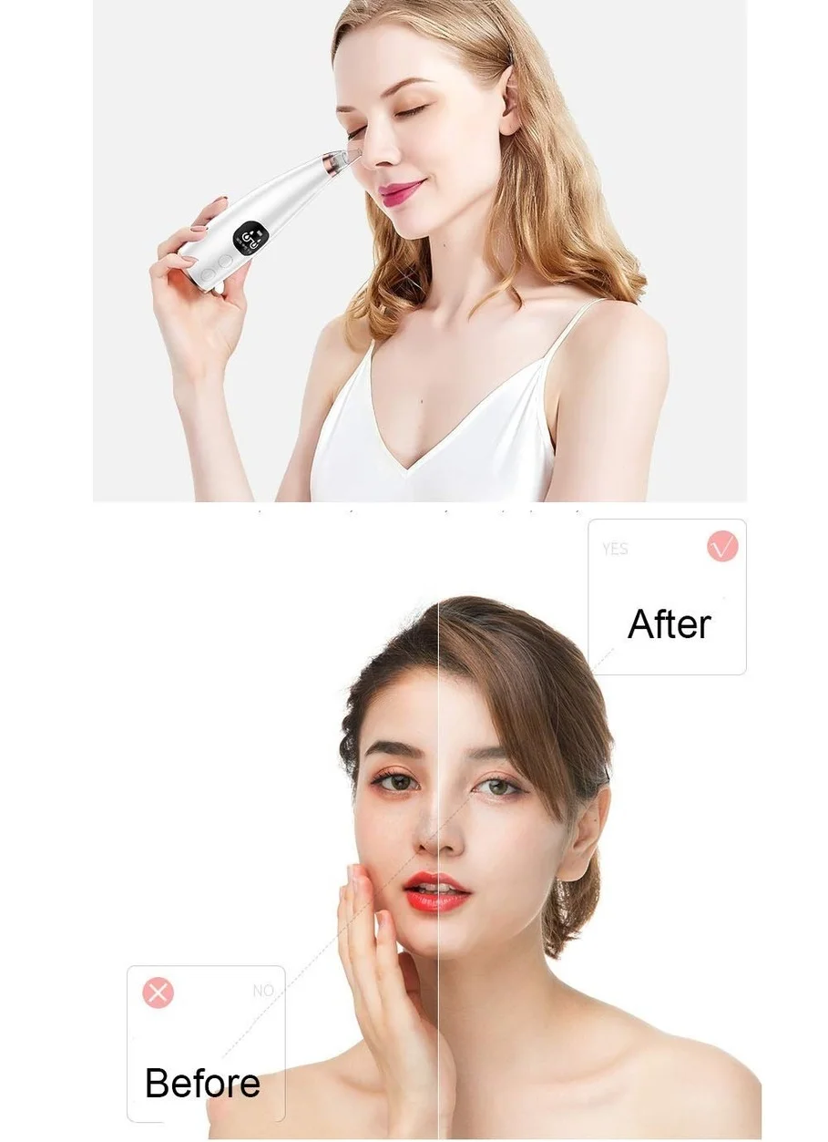 

Pore Vacuum Electric Acne Facial Pore Cleanser Suction Tool with LED Display Blackhead Remover skin tag remover beauty