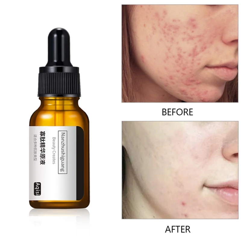 Олигопептид жидкий экстракт увлажняющий крем для очищения пор носа анти акне