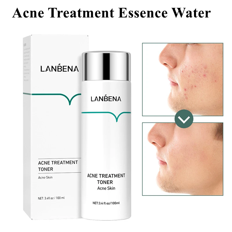 

AcneTreatmentTonerOligopeptideIsARefreshingThatGlidesOntoSkinToHelpKillAcne-CausingBacteriaWhileNourishingWithEssentialHydration