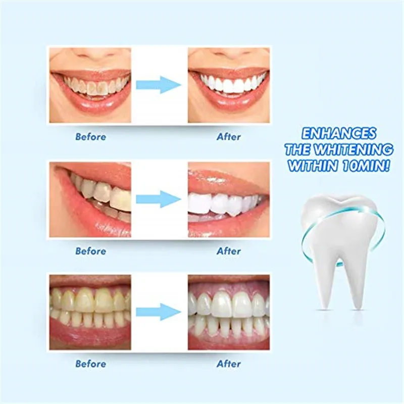 Новое поступление набор для отбеливания зубов светодиодный светильник более