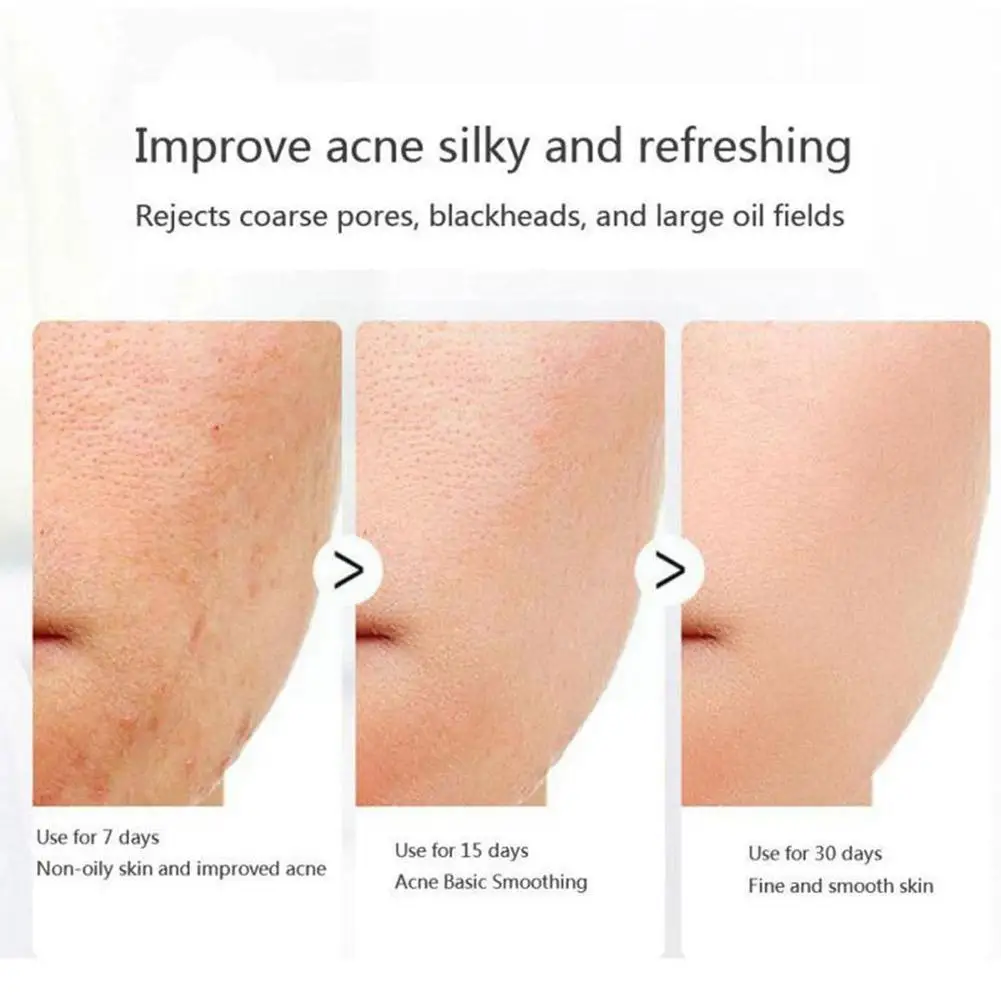 

Средство для умывания лица Vova Retinol, коллагеновый крем для лица, антивозрастной крем для сужения пор, средство для ухода за кожей, против лифт...