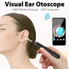 Отоскоп, умный визуальный прибор для чистки ушей, отоскоп, камера для удаления ушной серы, домашний осмотр ушей для детей и взрослых