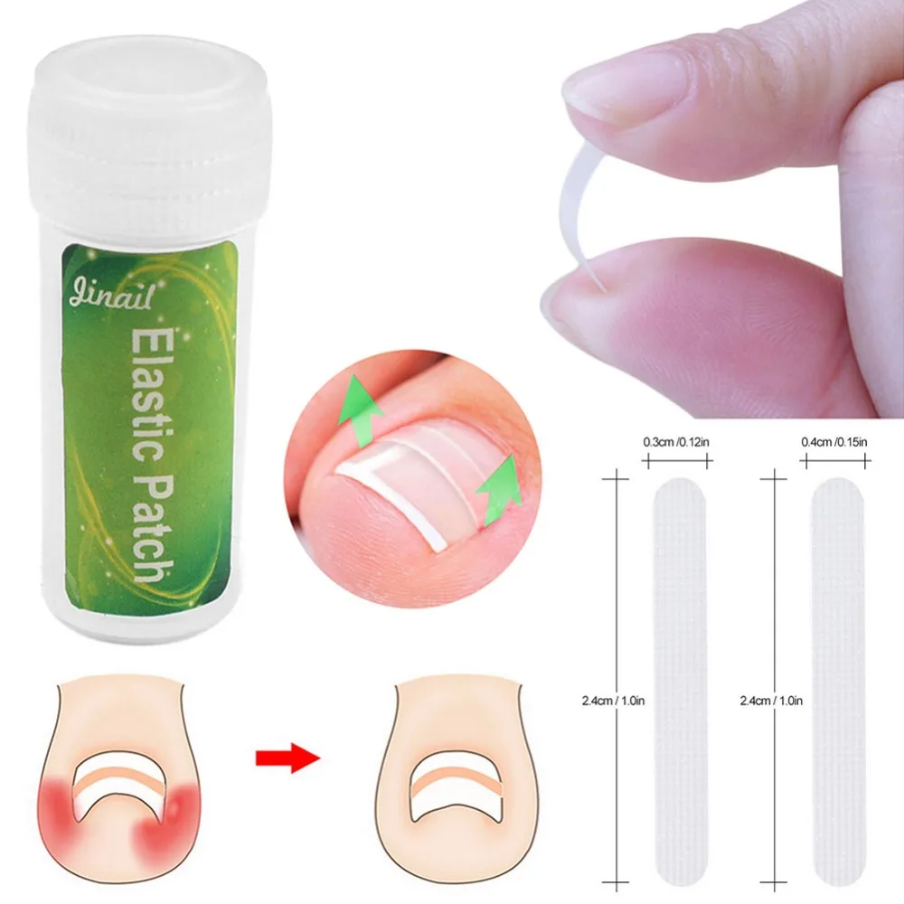 10 шт. инструмент для педикюра вросших ног зажим выпрямления изогнутый фиксатор