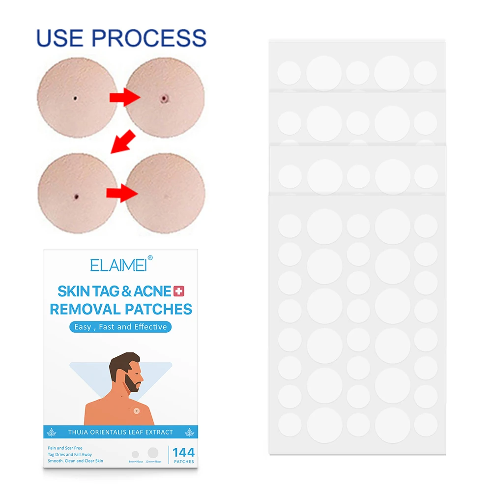 

144pcs Skin Mole Warts Removal Patch Women Men Skin Facial Care Tools Supplies Skin Tags Cleansing Remover Sticker