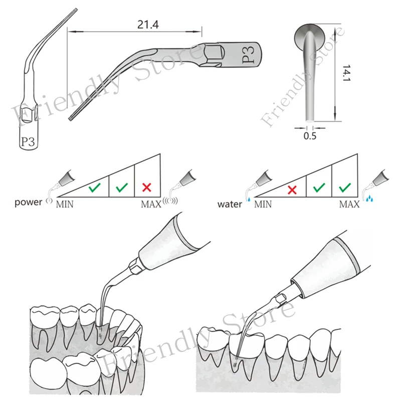 

5PCS Dental Perio scaling tip For Remove Subgingical And Deep Perio Calculus Compatible With EMS/Woodpecker Ultrasonic Scaler