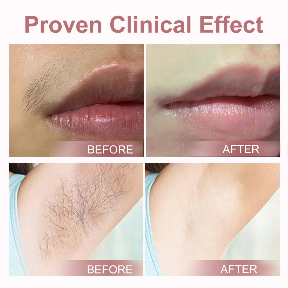 Qmele для женщин и мужчин безболезненная машина лазерной эпиляции IPL триммер тела