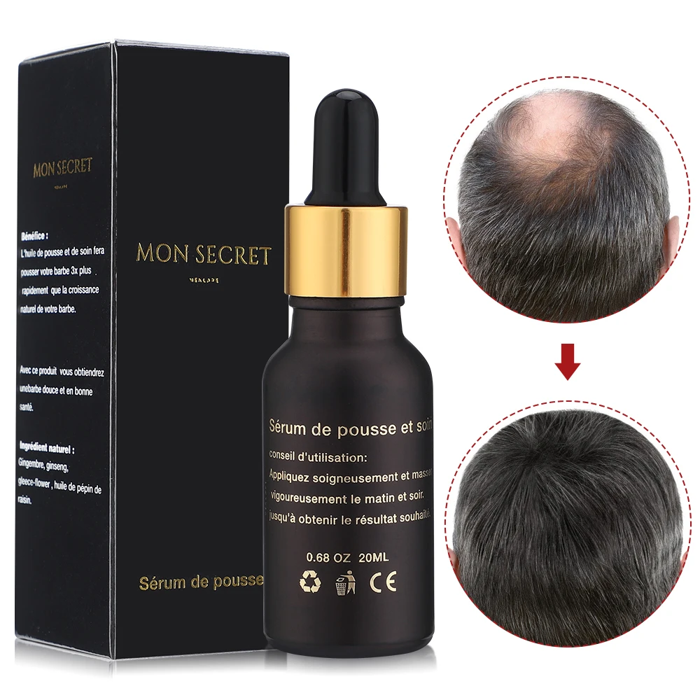 

Hair Growth Products Fast Growing Hair Oil Hair Loss Care Beauty Hair Scalp Treatment Hair Growth Essential Oil Men Women 20ml