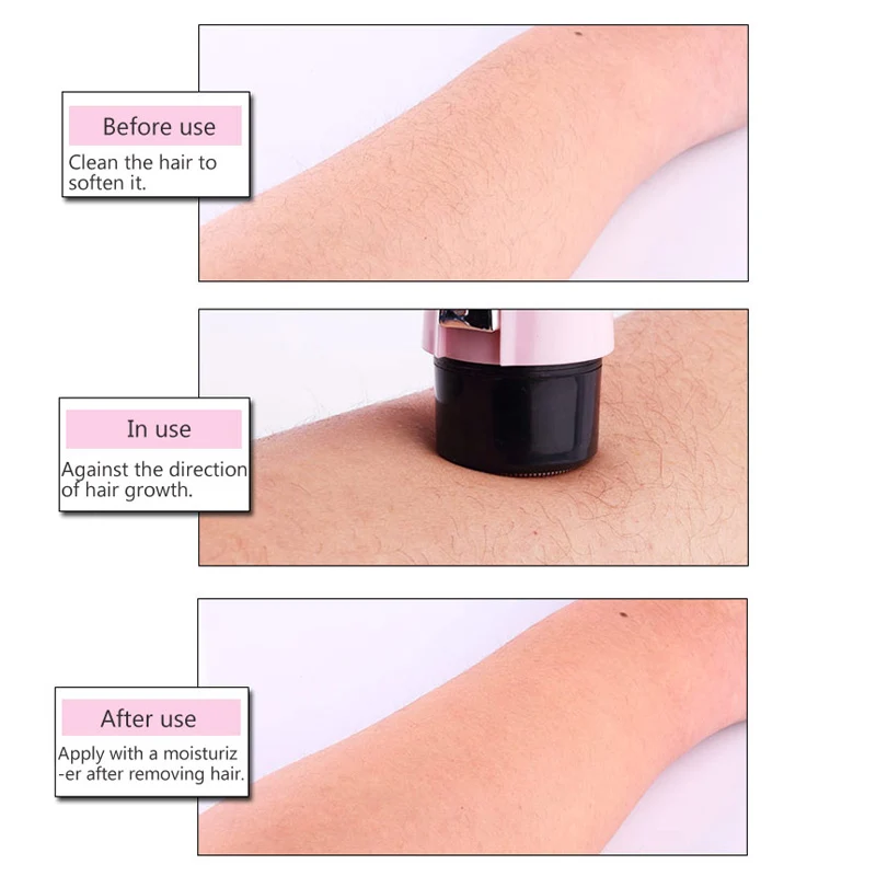 Kemei Portable Epilator Electric Hair Removal Battery Bikini Body Face Leg Underarm Depilador Femal Shaver Travel Essentials 38D | Бытовая