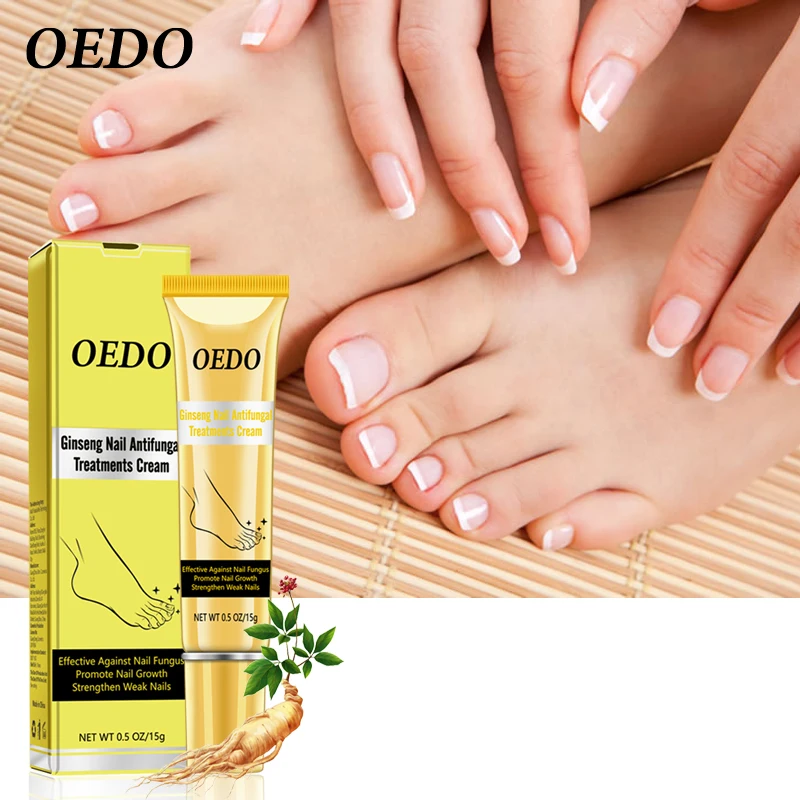Herbal Fungal Nail Treatment Ginseng Antifungal Treatments Cream Removal Repair Essence Onychomycosis Foot | Красота и здоровье