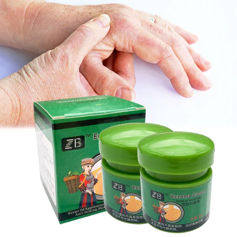 Мазь от экземы крем псориаза и зуда для ухода за кожей дерматита экзематоида