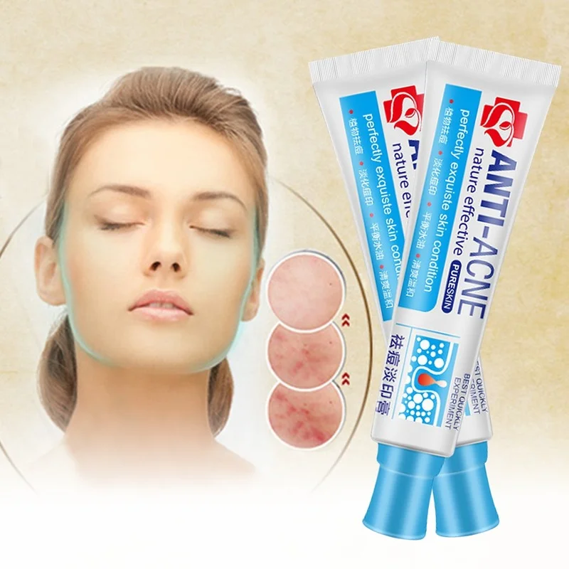 Сыворотка для лица acne control. Акне контроль. Акне контроль. Акне контроль. Acne control professional гель для.