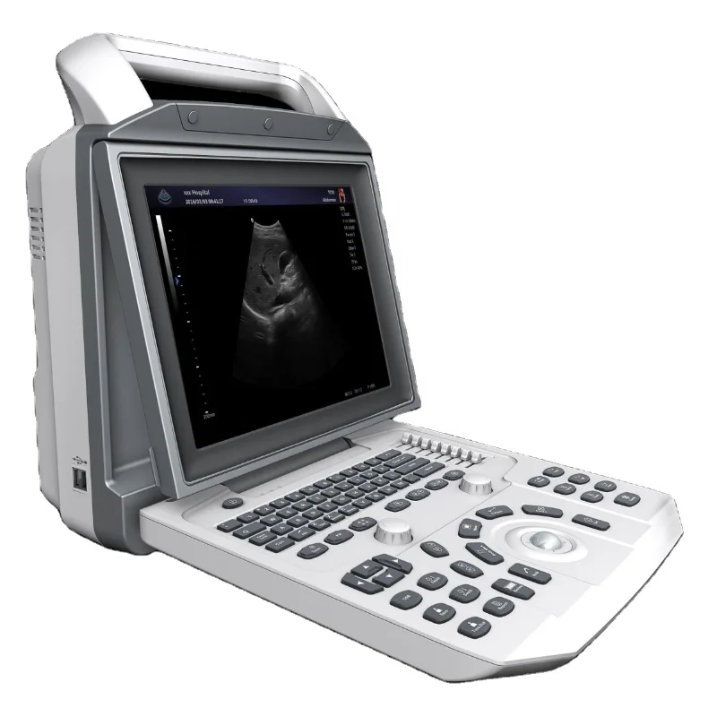 

Best Choice For B/W Ultrasound System MSLPU46 Clinical Ultrasonic Scanner
